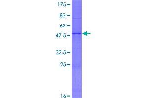Image no. 1 for Methyl-CpG Binding Domain Protein 3-Like 1 (MBD3L1) (AA 1-194) protein (GST tag) (ABIN1310469)