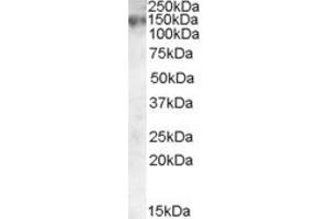 EB08734 (0. (ABCC1 anticorps  (Internal Region))
