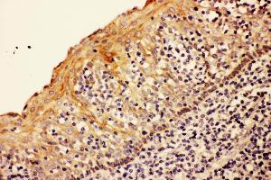 Anti- CASP8 antibody,IHC(P) IHC(P): Human Tonsil Tissue (Caspase 8 anticorps  (N-Term))