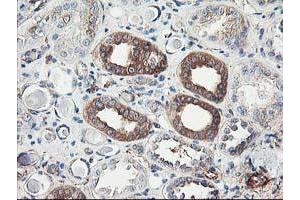 Immunohistochemical staining of paraffin-embedded Human Kidney tissue using anti-CDKN3 mouse monoclonal antibody. (CDKN3 anticorps)