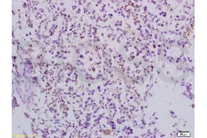 Formalin-fixed and paraffin embedded mouse lymphoma tissue labeled with Anti-TRAF3/CD40bp Polyclonal Antibody, Unconjugated (ABIN738921) at 1:200 followed by conjugation to the secondary antibody and DAB staining