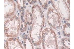 Detection of Grb10 in Human Kidney Tissue using Polyclonal Antibody to Growth Factor Receptor Bound Protein 10 (Grb10)
