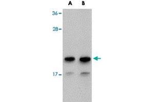 Western blot analysis of NDUFAF2 in Raji cell lysate with NDUFAF2 polyclonal antibody  at (A) 1 and (B) 2 ug/mL . (NDUFAF2 anticorps  (C-Term))