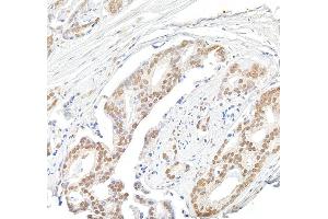 Immunohistochemistry (IHC) image for anti-Multiple Endocrine Neoplasia 1 (MEN1) (C-Term) antibody (ABIN7454589)