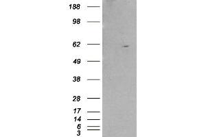 HEK293 overexpressing RXRB and probed with ABIN2559796 (mock transfection in first lane). (Retinoid X Receptor beta anticorps  (Internal Region))