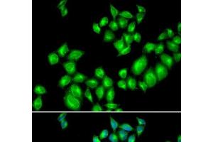 Immunofluorescence analysis of U2OS cells using DRD3 Polyclonal Antibody (DRD3 anticorps)