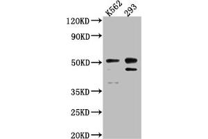 Western Blot Positive WB detected in: K562 whole cell lysate, 293 whole cell lysate All lanes: Caspase-2 antibody at 1:1000 Secondary Goat polyclonal to rabbit IgG at 1/50000 dilution Predicted band size: 51, 35, 11 kDa Observed band size: 51 kDa (Recombinant Caspase 2 anticorps)