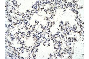 Rabbit Anti-SMARCD3 antibody        Paraffin Embedded Tissue:  Human Lung cell   Cellular Data:  Epithelial cells of renal tubule  Antibody Concentration:   4.