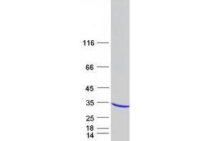 Validation with Western Blot