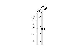 Western blot analysis of lysates from human placenta and heart tissue lysates (from left to right), using FRAT2 Antibody (C-term) (ABIN655793 and ABIN2845223).