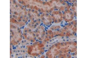 IHC-P analysis of kidney tissue, with DAB staining. (ACADS anticorps  (AA 210-397))