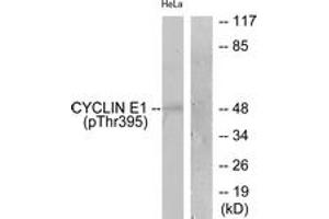 Western blot analysis of extracts from HeLa cells treated with Paclitaxel 1uM 60', using Cyclin E1 (Phospho-Thr395) Antibody. (Cyclin E1 anticorps  (pThr395))