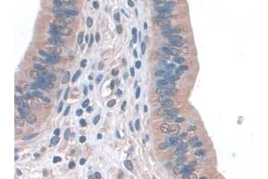 Detection of GPX3 in Mouse Uterus Tissue using Polyclonal Antibody to Glutathione Peroxidase 3, Plasma (GPX3)