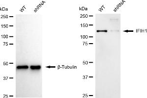 Western blotting analysis using IFIH1 antibody (ABIN7799084). (Recombinant IFIH1 anticorps)