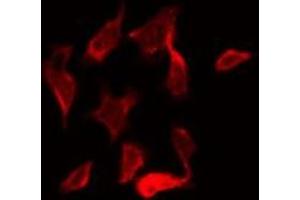 ABIN6269408 staining NIH-3T3 by IF/ICC. (CaMK2 alpha/delta anticorps)