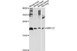 Western blot analysis of extracts of various cell lines, using MRPL22 antibody (ABIN6292563) at 1:1000 dilution.