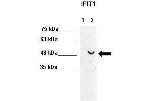 WB Suggested Anti-IFIT1 Antibody  Positive Control: Lane1: 30ug human Huh7, Lane2: 30ug human Huh7+IFNB stimulated  Primary Antibody Dilution :  1:1000 Secondary Antibody :  Anti-rabbit-HRP  Secondry Antibody Dilution :  1:5000 Submitted by: Takeshi Saito, USC Keck School of Medicine (IFIT1 anticorps  (C-Term))
