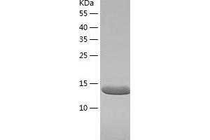 Western Blotting (WB) image for Ubiquitin-Conjugating Enzyme E2L 6 (UBE2L6) (AA 1-153) protein (His-IF2DI Tag) (ABIN7125622)