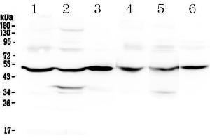 Western blot analysis of GDA using anti-GDA antibody .