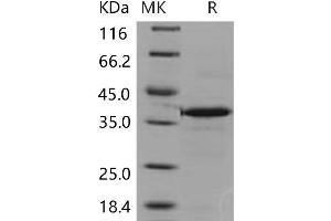 Western Blotting (WB) image for Carbonic Anhydrase VIII (CA8) (Active) protein (His tag) (ABIN7320152)