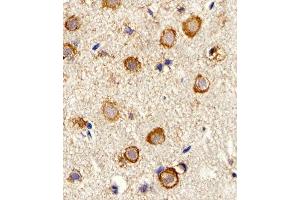 Immunohistochemical analysis of paraffin-embedded M.