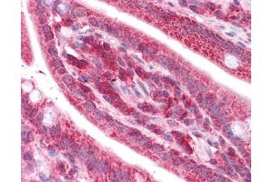 TST antibody was used for immunohistochemistry at a concentration of 4-8 ug/ml.