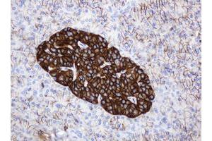 anti-CD99 (CD99) antibody