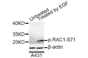 Western blot analysis of extracts of A-431 cells, using Phospho-RAC1-S71 antibody (ABIN5969930) at 1/1000 dilution. (RAC1 anticorps  (pSer71))