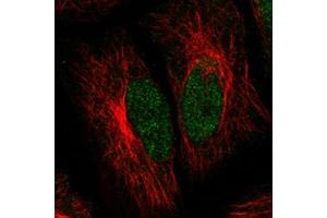 Immunofluorescent staining of HeLa cells with ATRX monoclonal antibody, clone CL0537  (Green) shows clear nuclear (without nucleoli) staining. (ATRX anticorps)