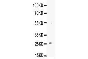 Anti-TREM1 antibody, Western blotting Lane 1: Recombinant Mouse TREM1 Protein 1ng