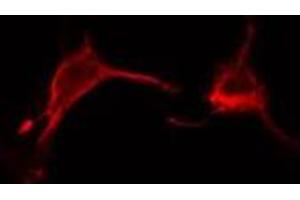 ABIN6278558 staining  Hela cells by IF/ICC.