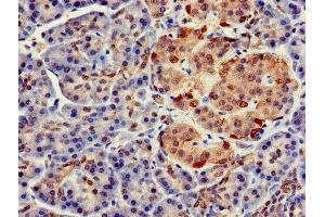 Immunohistochemistry of paraffin-embedded human pancreatic tissue using ABIN7152694 at dilution of 1:100 (FARP2 anticorps  (AA 261-550))