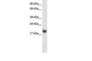 Image no. 1 for anti-Cysteine and Glycine-Rich Protein 3 (CSRP3) (C-Term) antibody (ABIN6735943) (CSRP3 anticorps  (C-Term))