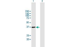 Western Blot analysis of UPRT expression in transfected 293T cell line by UPRT MaxPab polyclonal antibody.