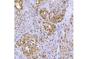 IHC analysis of SSRP1 using anti-SSRP1 antibody (ABIN7600496).