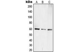 Western blot analysis of TCEB3C expression in Jurkat (A), mouse kidney (B), rat kidney (C) whole cell lysates.