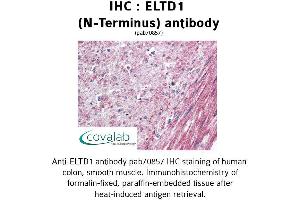 Image no. 1 for anti-EGF, Latrophilin and Seven Transmembrane Domain Containing 1 (ELTD1) (Extracellular Domain), (N-Term) antibody (ABIN1733980) (ELTD1 anticorps  (Extracellular Domain, N-Term))