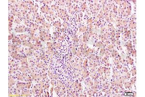 Formalin-fixed and paraffin embedded rat liver tissue labeled Anti-GHR Polyclonal Antibody, Unconjugated (ABIN671481) at 1:400, followed by conjugation to the secondary antibody and DAB staining (Growth Hormone Receptor anticorps  (AA 101-200))