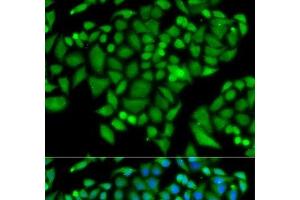anti-Chromatin Assembly Factor 1, Subunit B (p60) (CHAF1B) antibody