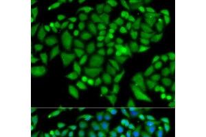 Immunofluorescence analysis of MCF-7 cells using CHAF1B Polyclonal Antibody (CHAF1B anticorps)