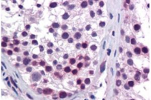 Human Testis: Formalin-Fixed, Paraffin-Embedded (FFPE)