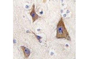 IHC analysis of FFPE human brain tissue stained with GPR49 antibody