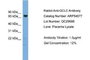 WB Suggested Anti-GCLC  Antibody Titration: 0. (GCLC anticorps  (Middle Region))