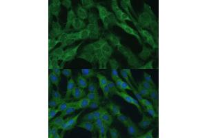 Immunofluorescence analysis of C6 cells using IDH1 Polyclonal Antibody (ABIN6131797, ABIN6142143, ABIN6142144 and ABIN6217174) at dilution of 1:100 (40x lens).