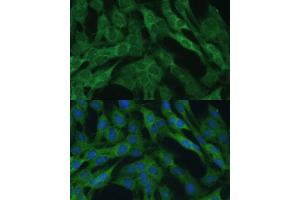 Immunofluorescence analysis of C6 cells using IDH1 Polyclonal Antibody (ABIN6131797, ABIN6142143, ABIN6142144 and ABIN6217174) at dilution of 1:100 (40x lens). (IDH1 anticorps  (AA 1-414))