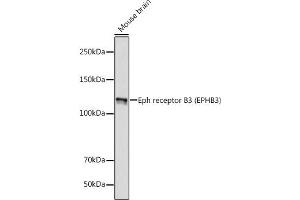 Western blot analysis of extracts of Mouse brain, using Eph receptor B3 (EPHB3) (EPHB3) antibody (ABIN7266972) at 1:1000 dilution. (EPH Receptor B3 anticorps)