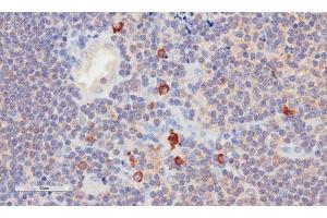 Immunohistochemical staining of human tonsil tissue using anti-CD3E antibody.