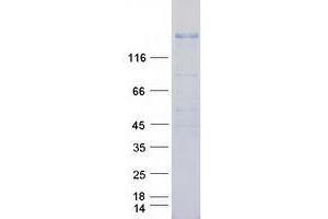 Validation with Western Blot