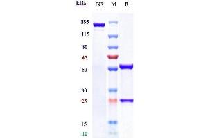 Anti-CD38 Reference Antibody (isatuximab) on SDS-PAGE under reducing (R) condition. (Recombinant CD38 (Isatuximab Biosimilar) anticorps)