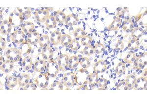 Detection of FABP1 in Rat Kidney Tissue using Polyclonal Antibody to Fatty Acid Binding Protein 1 (FABP1)